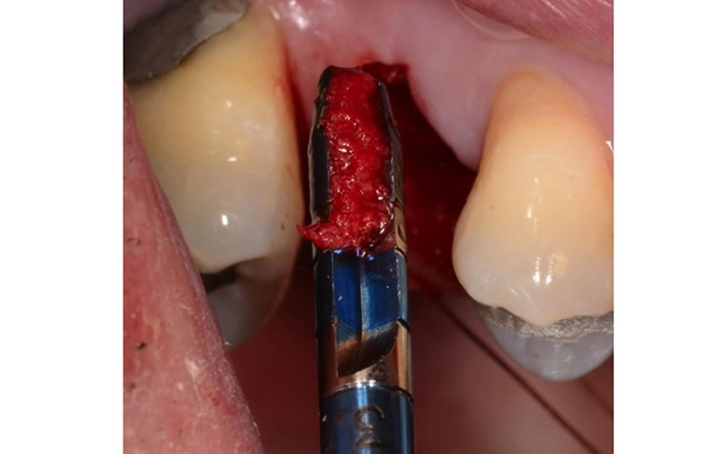 psicosomatica